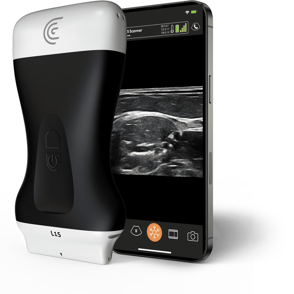 Ecógrafo portátil Clarius L15 HD3