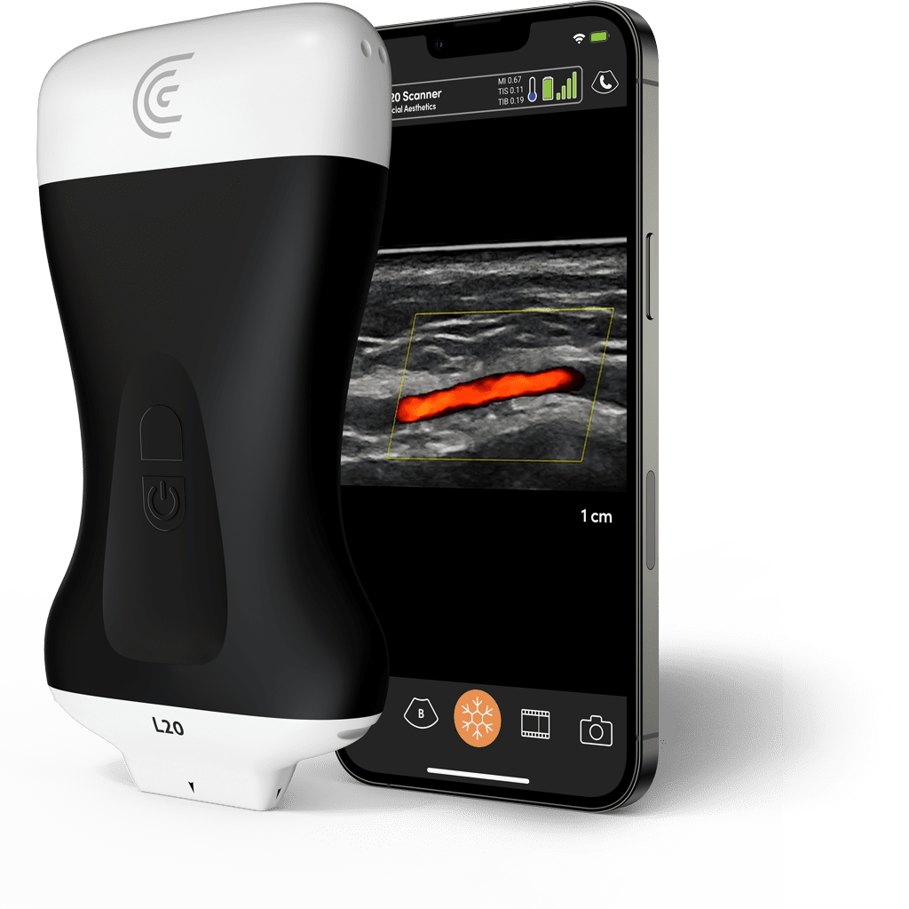 Ecógrafo portátil Clarius L20 HD3