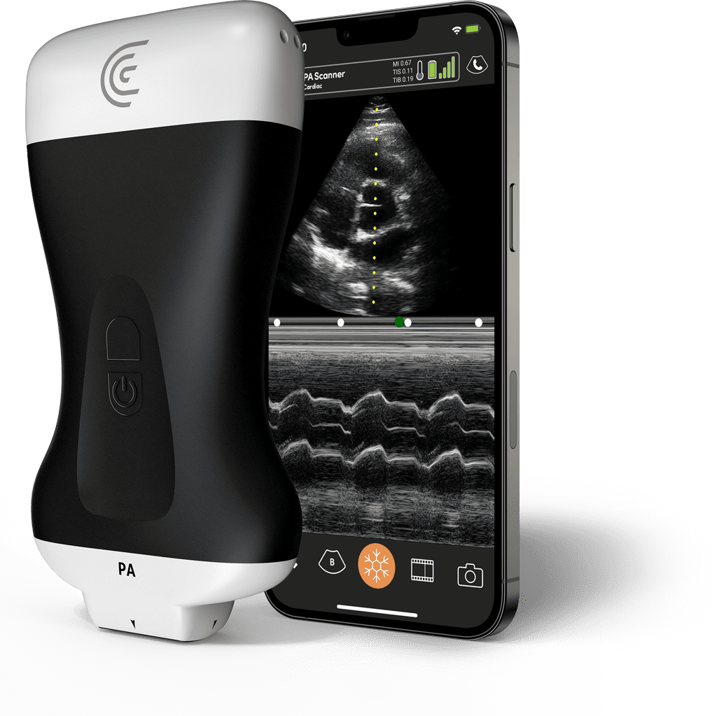 Ecógrafo portátil Clarius PA HD3